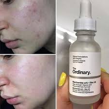 Ordinary Serum Niacinamide 10% + Zinc 1% 30ml