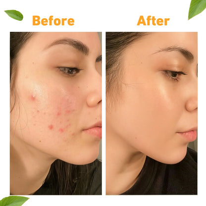 Super Bright Vitamin C16 Serum (Clear, Even Tone & Super Bright Skin)