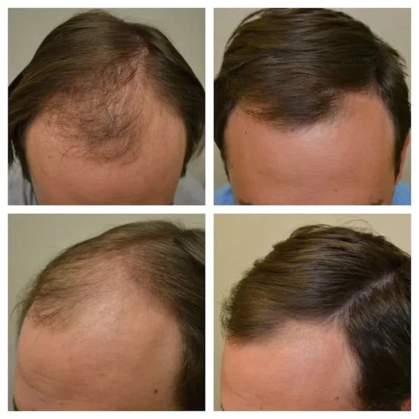 Proskire serum detail