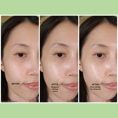 Orien Soothing Spray Toner for Spotless Skin - Removes Acne, Fades Dark Spots, Reveals Glow