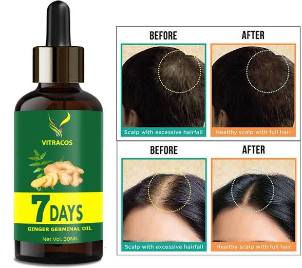 Hair Regrowth Deal - include karseell hair mask, 7 days Ginger Hair Oil and Drama Roller