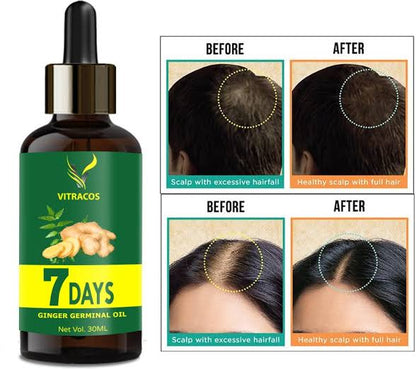 Hair Regrowth Deal - include karseell hair mask, 7 days Ginger Hair Oil and Drama Roller