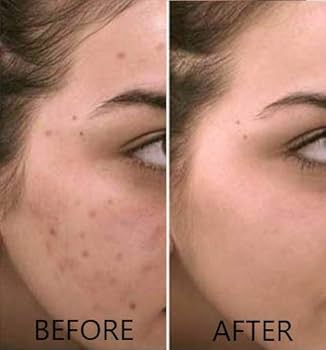 Super Bright Vitamin C16 Serum (Clear, Even Tone & Super Bright Skin)