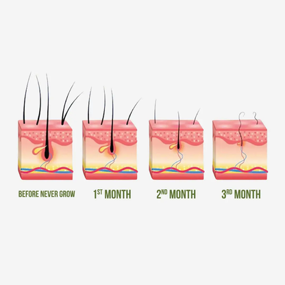 Herbs Asia Never Grow Hair Delay Serum | Permanent Hair Growth Inhibitor for Face & Body | Buy 1 Get 1 Free