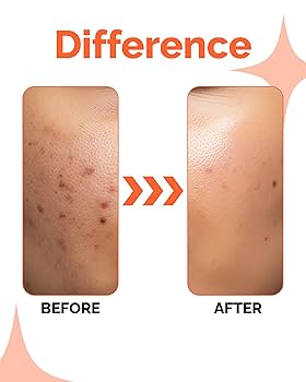 Super Bright Vitamin C16 Serum (Clear, Even Tone & Super Bright Skin)