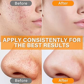 Super Bright Vitamin C16 Serum (Clear, Even Tone & Super Bright Skin)