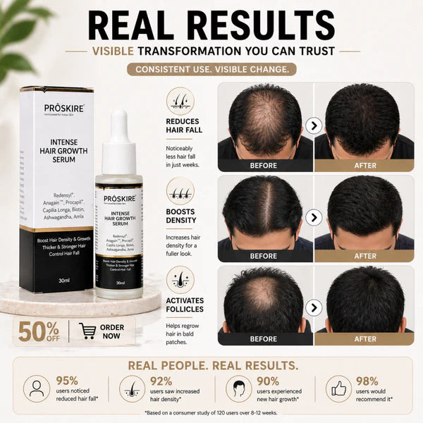 Proskire Hair Growth Serum – Reduces Hair Fall, Boosts Hair Density, Activates Follicles – For Bald Patches, Receding Hairline & Thinning Hair