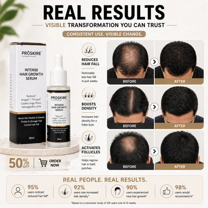 Proskire Hair Growth Serum – Reduces Hair Fall, Boosts Hair Density, Activates Follicles – For Bald Patches, Receding Hairline & Thinning Hair