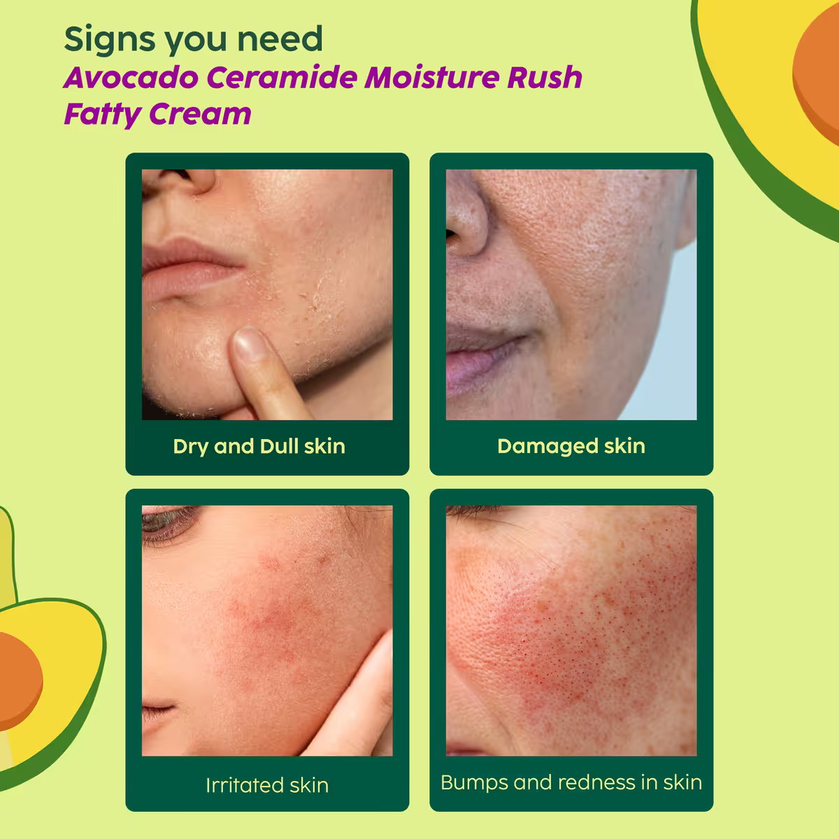 Avocado Ceramide Moisture Rush Fatty Cream for Barrier Repair & 100 HR Moisture