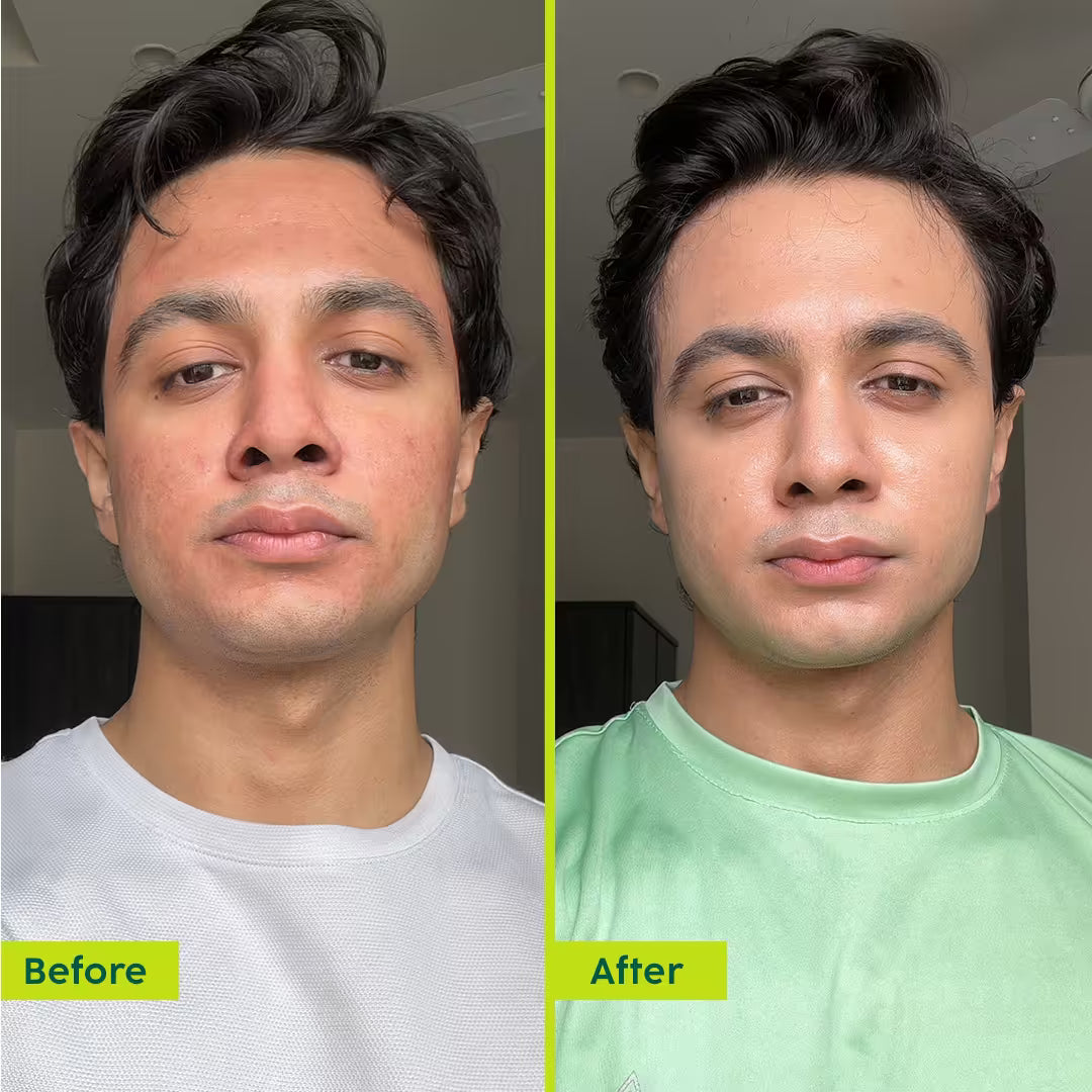 Avocado Ceramide Moisture Rush Fatty Cream for Barrier Repair & 100 HR Moisture