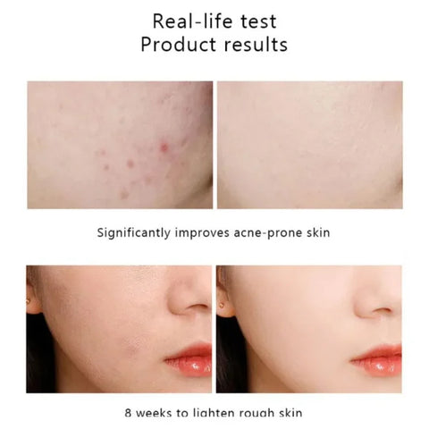 Ordinary Serum Niacinamide 10% + Zinc 1% 30ml