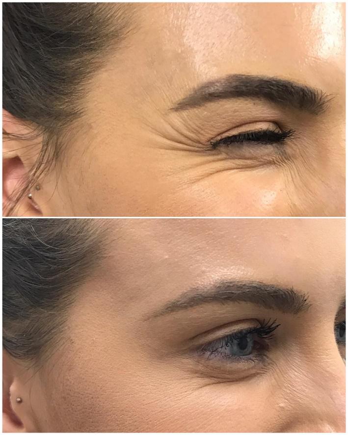 Iconic Clarins Double Serum - For Anti-Wrinkle & instant brightening