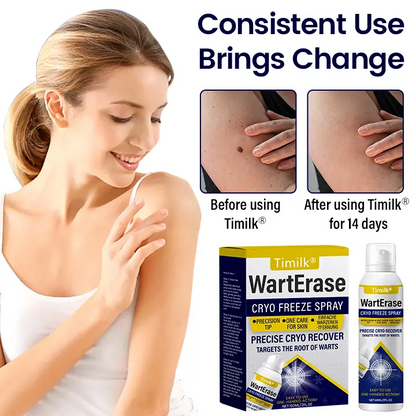 Timilk Wart & Mole Removal Spray | Painless, Fast Acting & Scar Free Skin | Best for Warts, Moles & Skin tags